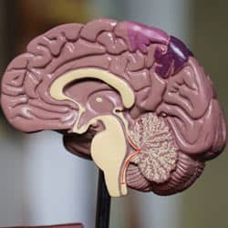  A model of a brain